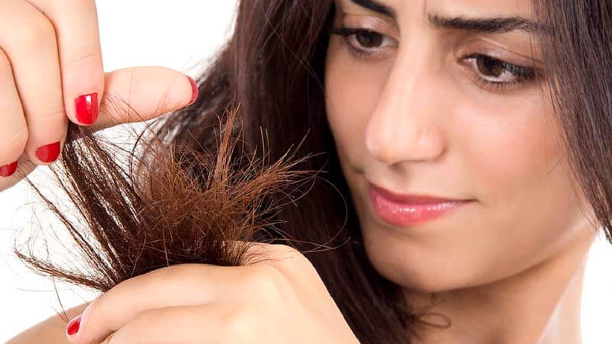 Tóc bị chẻ ngọn là biểu hiện của hư tổn