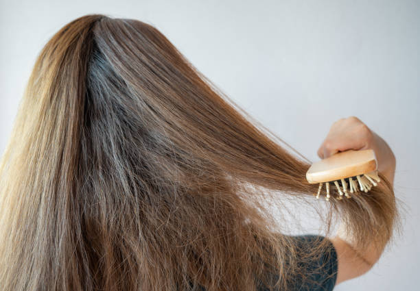 Tóc khô thường dễ rối và gãy rụng