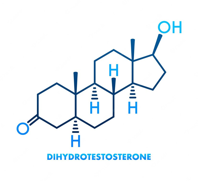 Dihydrotestosterone - tác nhân gây rụng tóc nhiều