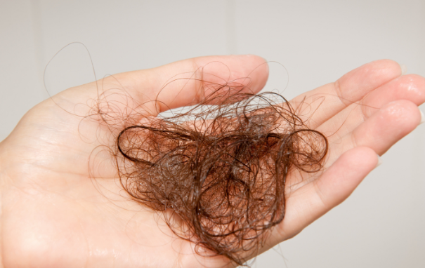 Nếu tóc rụng hơn 100 sợi/ngày thì bạn đang gặp hiện tượng tóc rụng nhiều