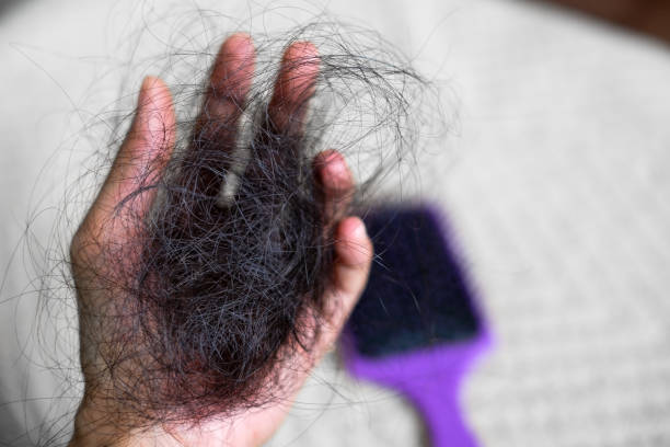 Top 8 nguyên nhân gây tóc rụng nhiều tuổi 50 và giải pháp khắc phục