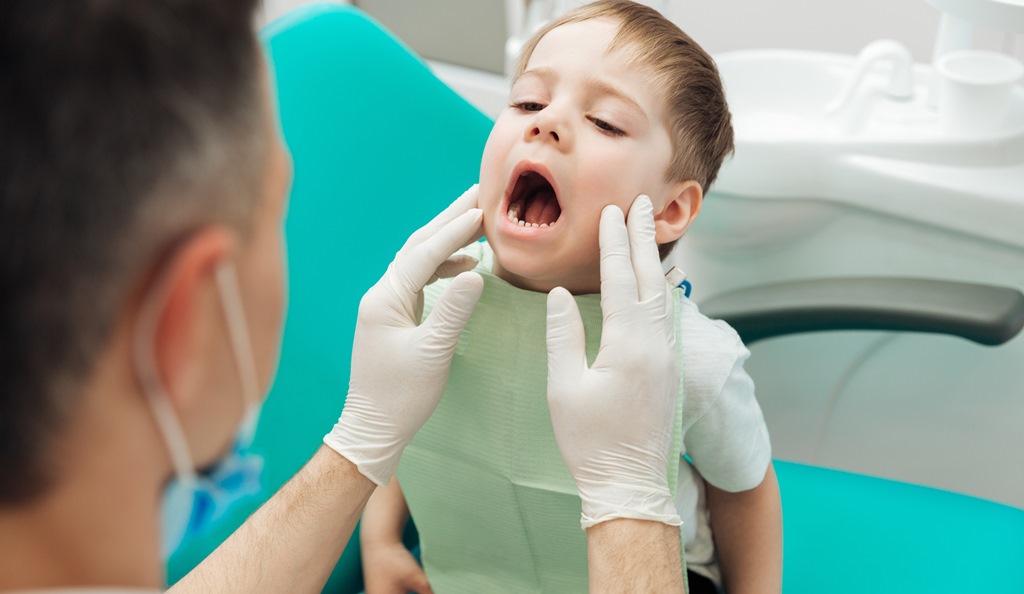 Điều trị chỉnh hình răng hàm mặt sớm