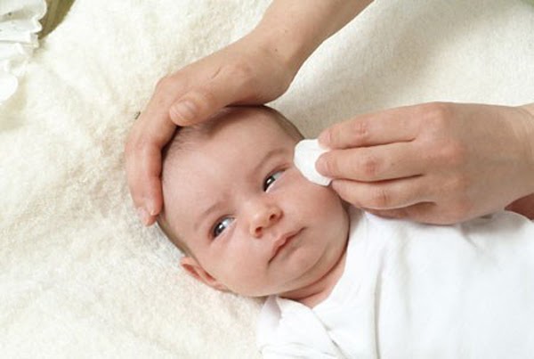 Phát hiện sớm tình trạng đau mắt đỏ ở trẻ sơ sinh