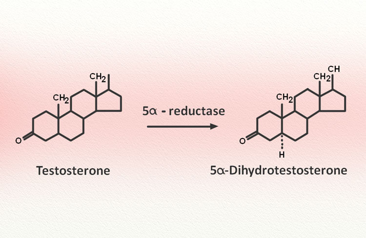 Enzyme 5-alpha reductase xúc tác tạo thành chất kích thích tăng kích thước tiền liệt tuyến