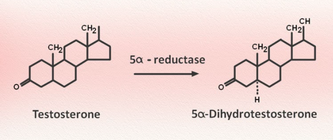 Enzyme 5-alpha reductase xúc tác phản ứng chuyển testosterone thành dihydrotestosterone (DHT)