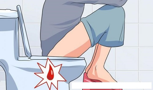 Chảy máu khi đi vệ sinh