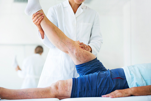 Nguyên nhân gây suy giãn tĩnh mạch chân là gì?