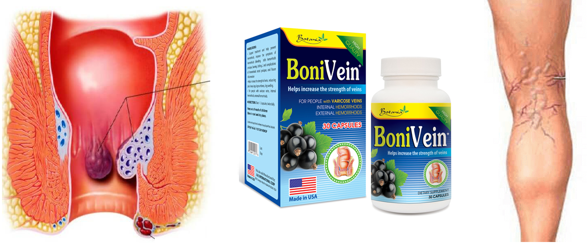 BoniVein - Sản phẩm của Mỹ giúp cải thiện đồng thời suy giãn tĩnh mạch và trĩ