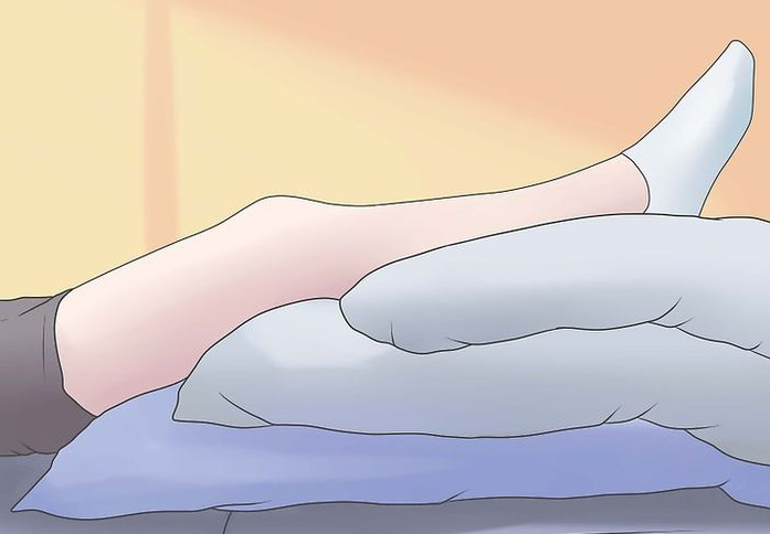 Việc kê cao chân khi ngủ tốt cho người bệnh suy giãn tĩnh mạch chân