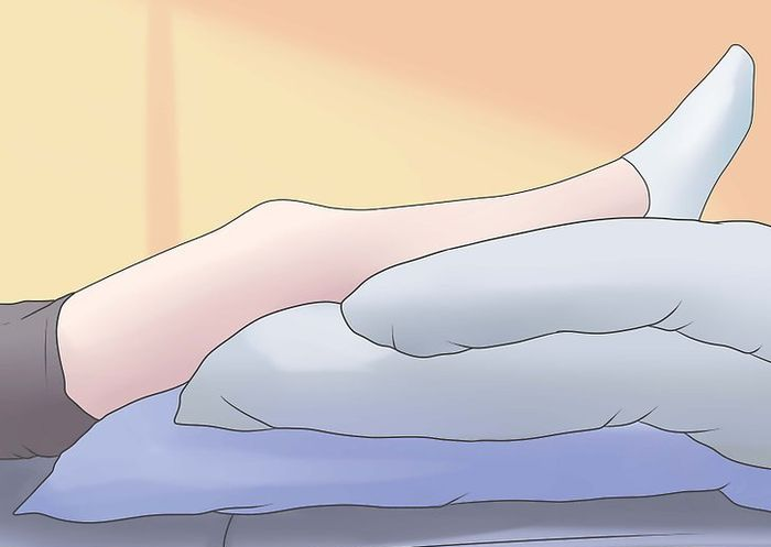 Kê cao chân khi ngủ tốt cho người bị suy giãn tĩnh mạch