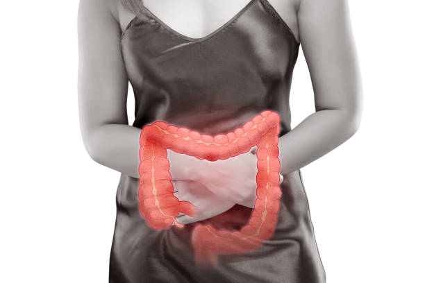 Hội chứng ruột kích thích thường gây đau bụng quặn