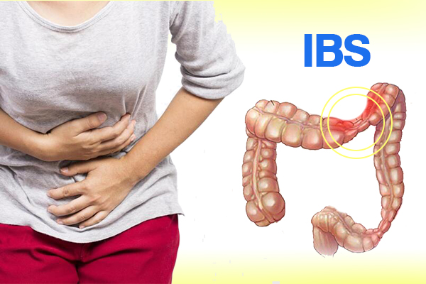 Phải làm gì để giảm đau cho người mắc IBS.