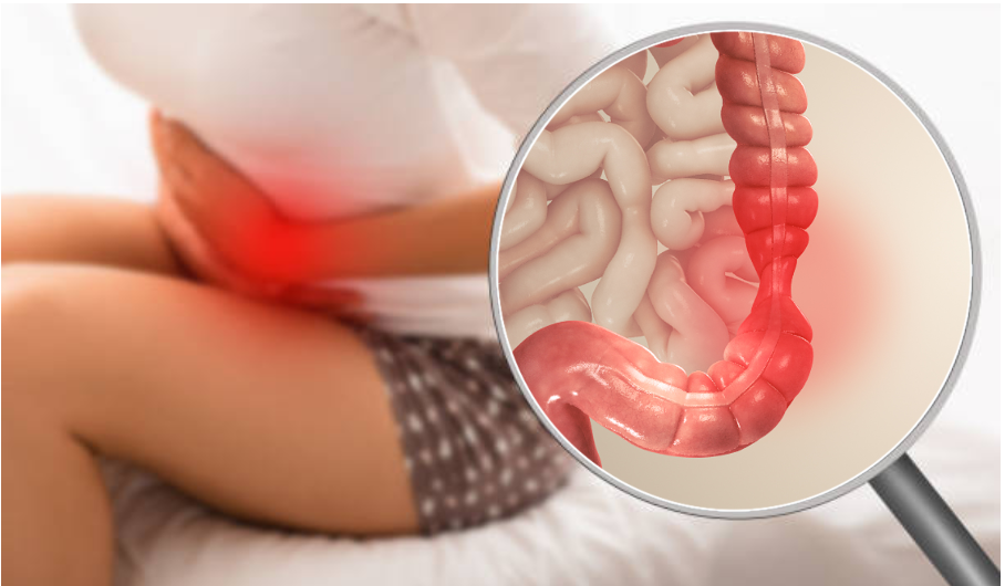 Sự nhạy cảm của hệ thần kinh ruột khiến người bệnh cứ ăn vào là đau bụng đi ngoài