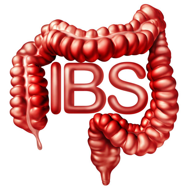 Người bệnh cần phát hiện và khắc phục IBS càng sớm càng tốt