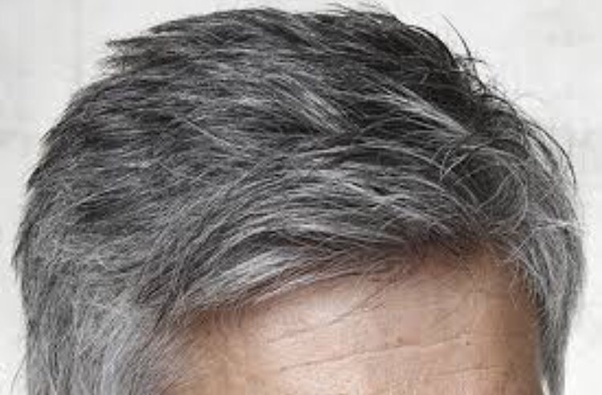 Nguyên nhân tóc bạc sớm là gì ?