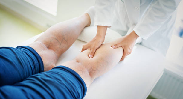 Cách chăm sóc đôi chân cho người bệnh suy giãn tĩnh mạch vào mùa lạnh
