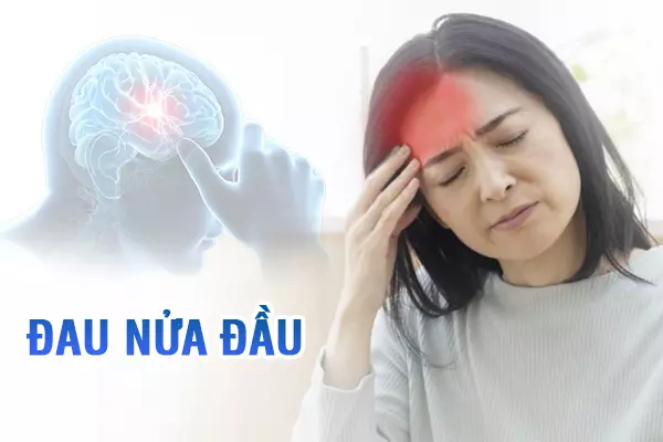 Bạn biết gì về chứng đau nửa đầu?
