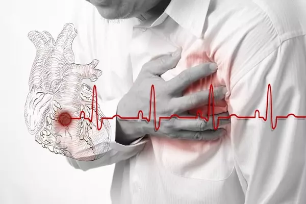 Béo phì là nguyên nhân hàng đầu gây ra các vấn đề về tim mạch