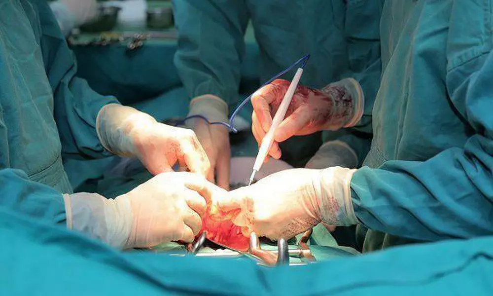 Phẫu thuật giúp loại bỏ khối u não