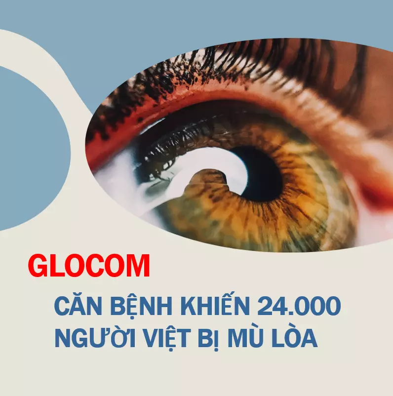 Hưởng ứng tuần lễ Glocom thế giới - Căn bệnh khiến 24.000 người Việt mù lòa