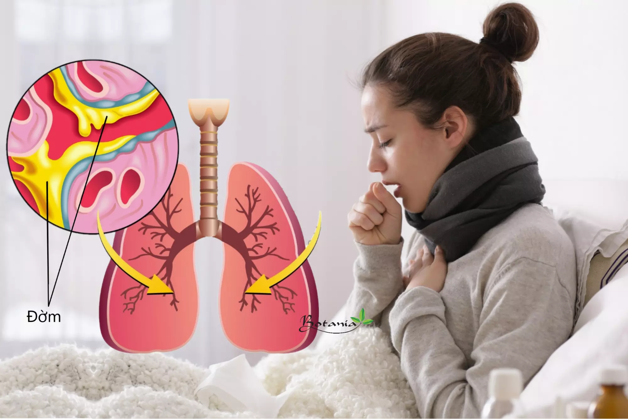Cập nhật kiến thức về viêm phổi để việc điều trị trở lên hiệu quả
