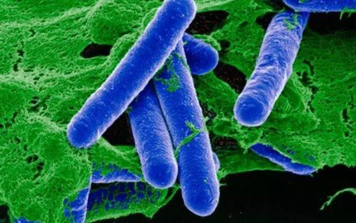 Hình ảnh vi khuẩn Clostridium botulinum