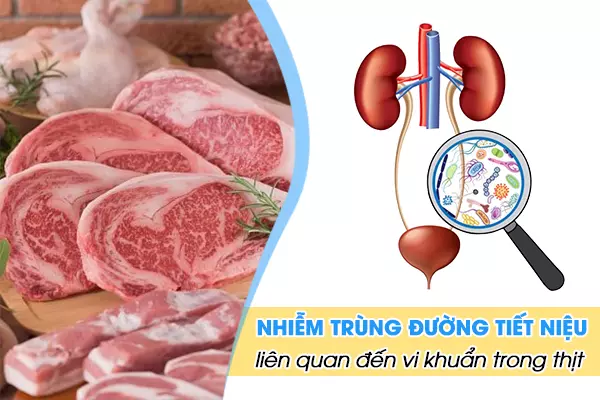 Nhiễm trùng đường tiết niệu liên quan đến vi khuẩn trong thịt