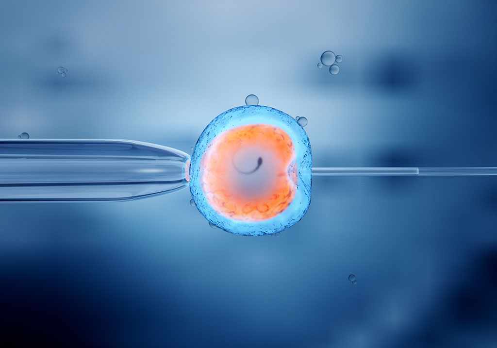 Thực hiện phương pháp thụ tinh trong ống nghiệm để tăng cơ hội mang thai