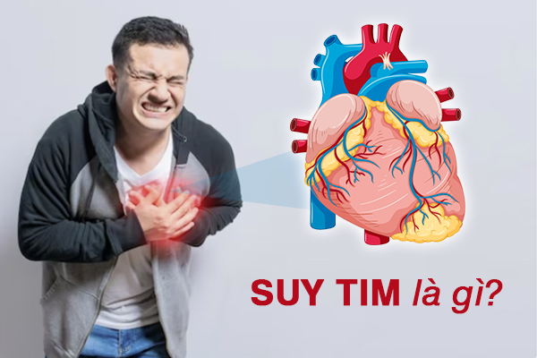 Suy tim là gì? Phân loại và phân độ của suy tim