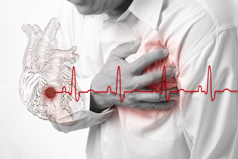 Suy tim cũng là một nguyên nhân gây tràn dịch màng phổi