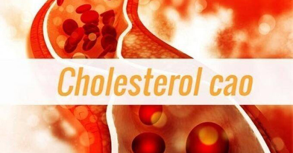 Người có cholesterol cao nên hạn chế ăn trứng gà