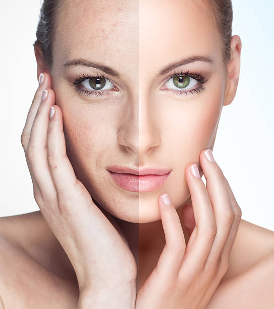 Niacinamide có tác dụng làm mờ và ngăn ngừa tăng sắc tố da.