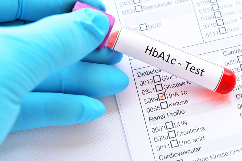 Chỉ số HbA1c an toàn nhưng đường huyết cao có nguy hiểm không?