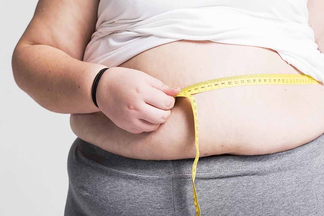 Người béo phì có nguy cơ cao bị gan nhiễm mỡ