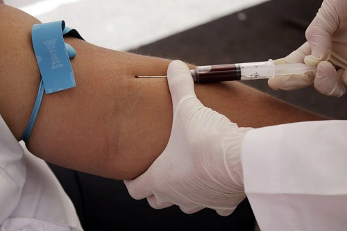 Lấy máu xét nghiệm CEA
