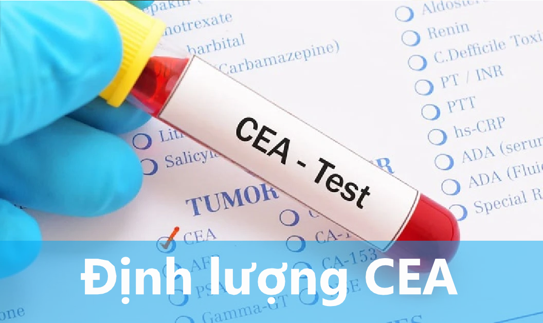 Ý nghĩa của xét nghiệm định lượng CEA đối với người bệnh ung thư