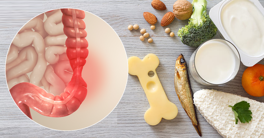 Hội chứng ruột kích thích nên ăn gì? Cần kiêng gì?