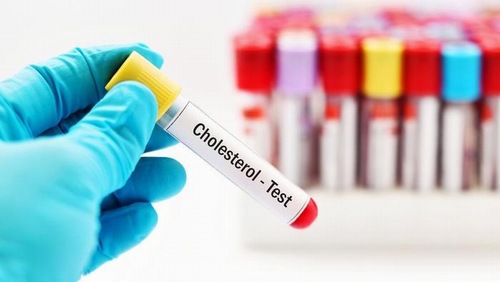 Định lượng cholesterol toàn phần giúp chẩn đoán và theo dõi các bệnh lý