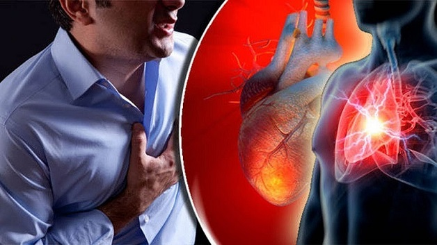 Bị nhồi máu cơ tim sau 15 năm hút thuốc lá