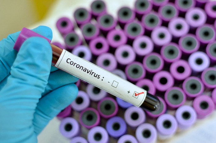 Vaccine phòng ngừa virus corona mới (2019-nCoV) được thử nghiệm trên động vật