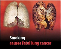 Tác hại của thuốc lá